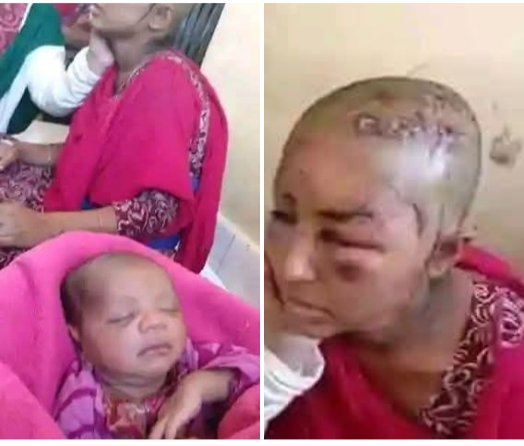কন্যাসন্তান জম্ম দেয়ার দায়ে স্বামী ও শ্বশুরবাড়ির নির্মম নির্যাতনের শিকার হয়েছে এক নারী।