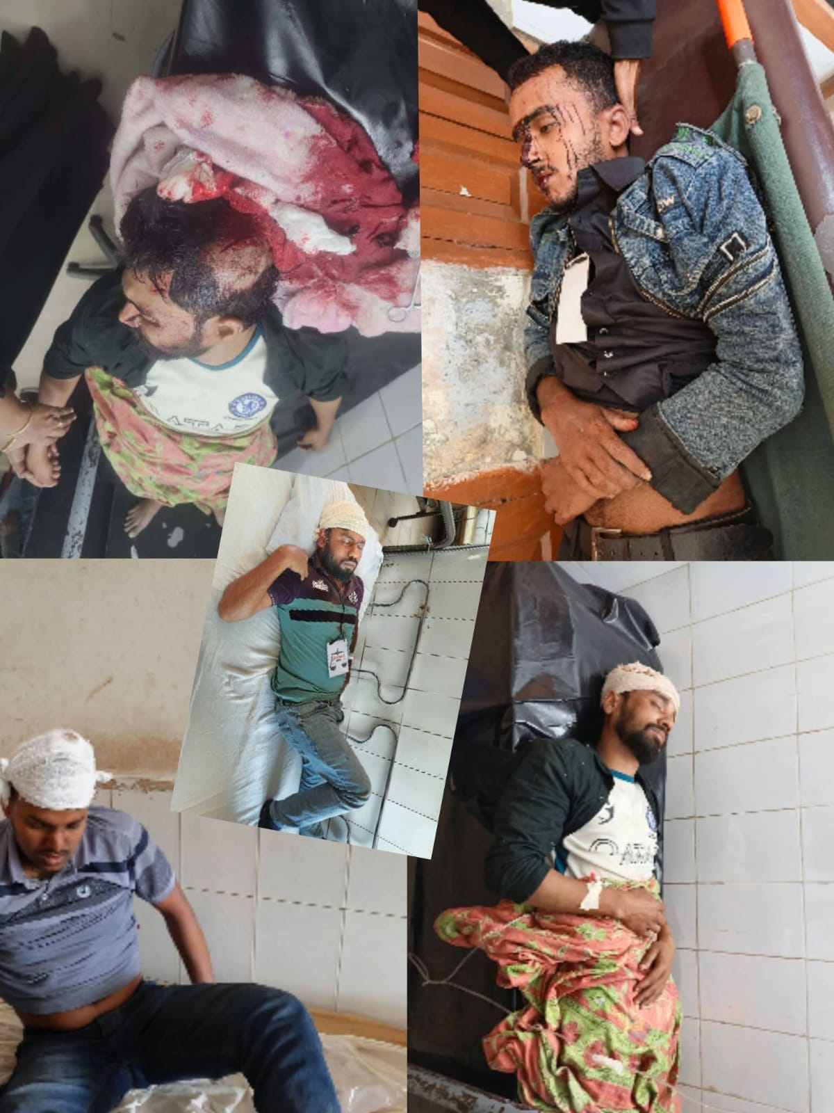 শরনখোলার সোনাতলা ভোটকেন্দ্রের আধা কিলোমিটার দুরে বি এন পি জামাত সংঘর্ষে আহত:১৯