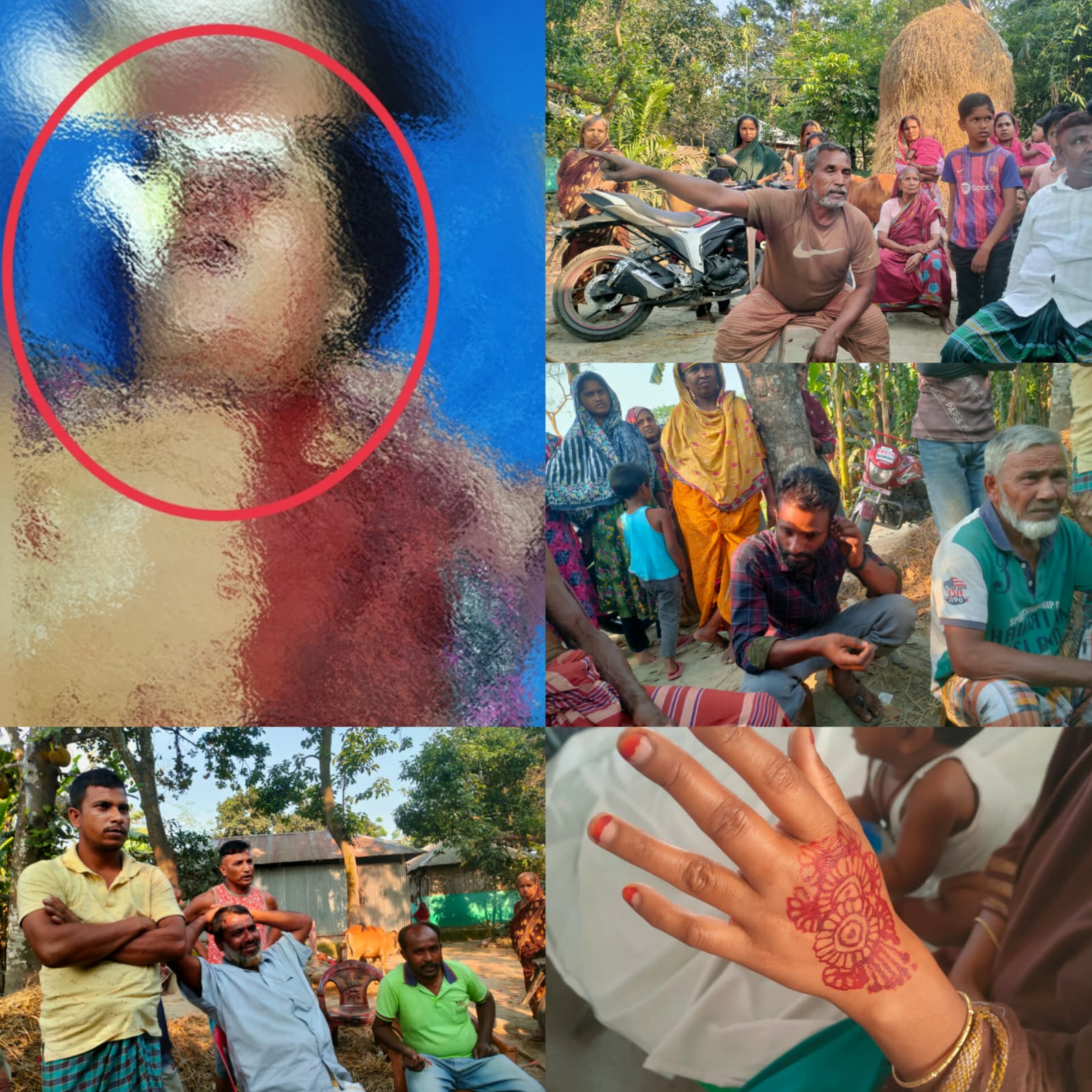 পঞ্চগড়ের দেবীগঞ্জে মাদকবিরোধী প্রতিবাদকে ঘিরে সংঘর্ষ, নারীর নাক বিচ্ছিন্ন