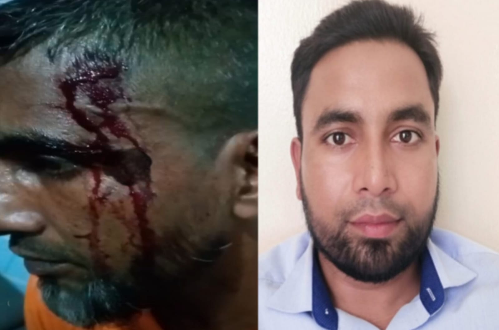 কটিয়াদীতে জমি বিরোধে সাবেক সেনা সদস্যকে কুপিয়ে জখম, অভিযুক্ত আপন ছোট ভাই