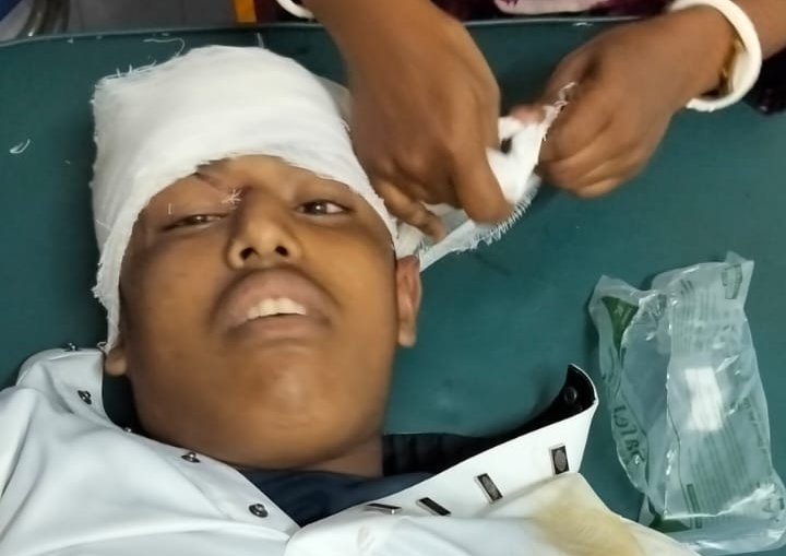 টুঙ্গিপাড়ায় মোটরসাইকেল দুর্ঘটনায় কিশোর নিহত, গুরুতর আহত আরও দুই