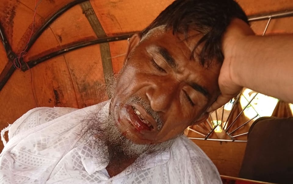 শায়েস্তাগঞ্জে ট্রাকের ধাক্কায় মোটরসাইকেল আরোহী নিহত